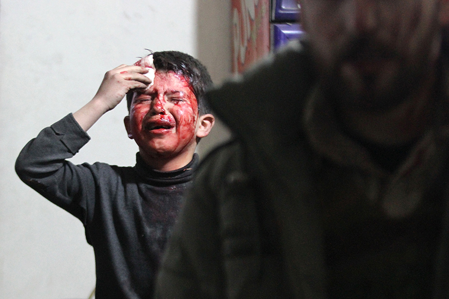 An injured boy reacts in a field hospital after what activists said were air strikes by forces loyal to Syria's President Bashar al-Assad in the Douma neighbourhood of Damascus