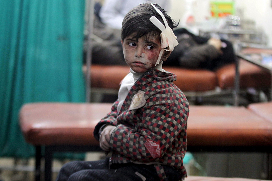 An injured boy waits inside a field hospital after what activists said were air strikes and shelling by forces loyal to Syria's President Bashar al-Assad in the Douma neighborhood of Damascus